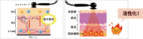 ラジオ波のしくみ